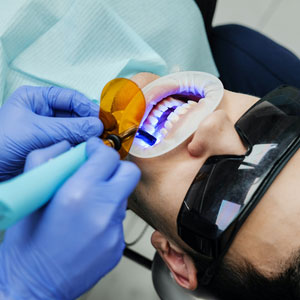 Laser Dentistry in Thornhill