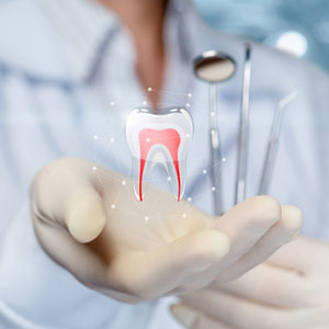 Root Canal Therapy in North York